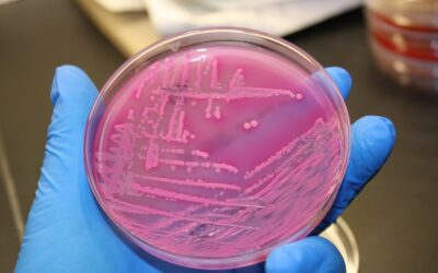Worried about E. coli? How to keep your drinking water clean